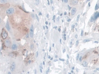 Immunohistochemistry (Formalin/PFA-fixed paraffin-embedded sections) - Anti-Kallikrein 14 antibody (AB232966), expandable thumbnail