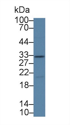 Western blot - Anti-Kallikrein 14 antibody (AB232966), expandable thumbnail