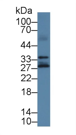 Western blot - Anti-Kallikrein 14 antibody (AB232966)