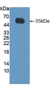 Western blot - Anti-Kallikrein 14 antibody (AB232966)