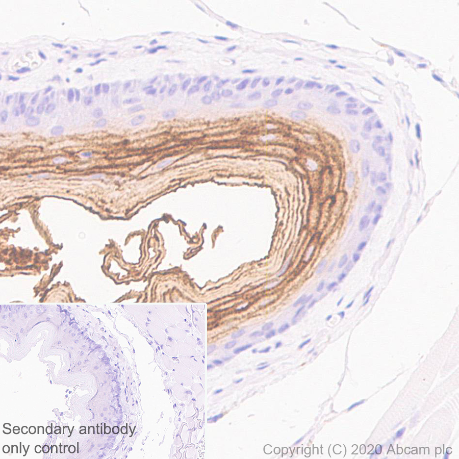 Immunohistochemistry (Formalin/PFA-fixed paraffin-embedded sections) - Anti-Kallikrein 14 antibody [EPR23570-293] (AB278500)