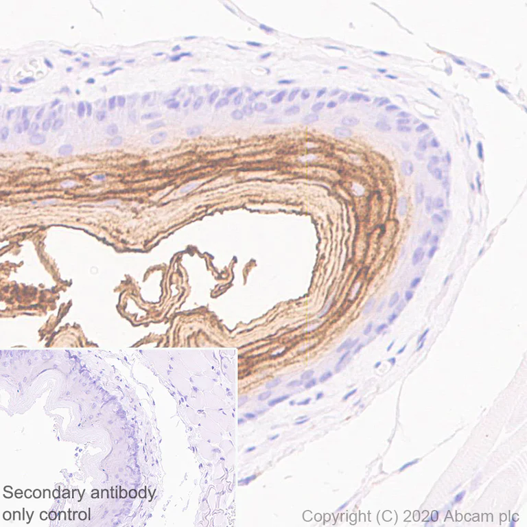 Immunohistochemistry (Formalin/PFA-fixed paraffin-embedded sections) - Anti-Kallikrein 14 antibody [EPR23570-293] - BSA and Azide free (AB278506)