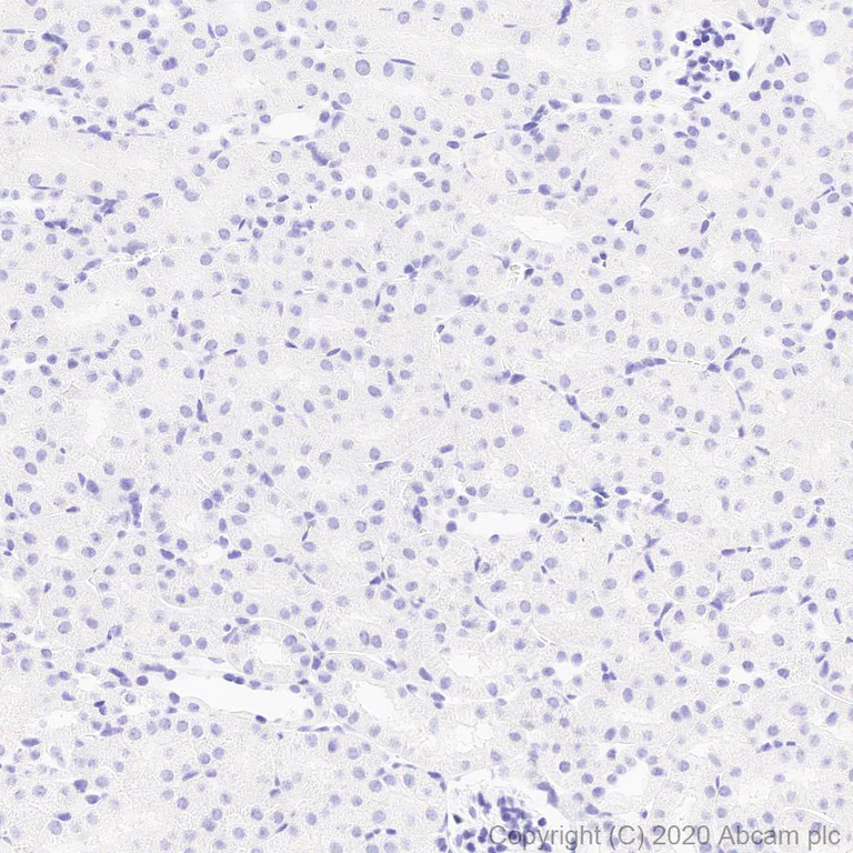 Immunohistochemistry (Formalin/PFA-fixed paraffin-embedded sections) - Anti-Kallikrein 14 antibody [EPR23570-293] - BSA and Azide free (AB278506)
