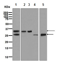 Western blot - Anti-Kallikrein 14 antibody [EPR7209] (AB128957)