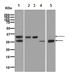 Western blot - Anti-Kallikrein 14 antibody [EPR7209] - BSA and Azide free (AB248246)