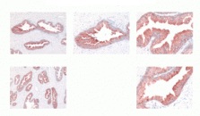 Immunohistochemistry (Formalin/PFA-fixed paraffin-embedded sections) - Anti-Kallikrein 2/KLK2 antibody [6B7] (AB40749)