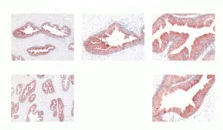 Immunohistochemistry (Formalin/PFA-fixed paraffin-embedded sections) - Anti-Kallikrein 2/KLK2 antibody [6B7] (AB40749)