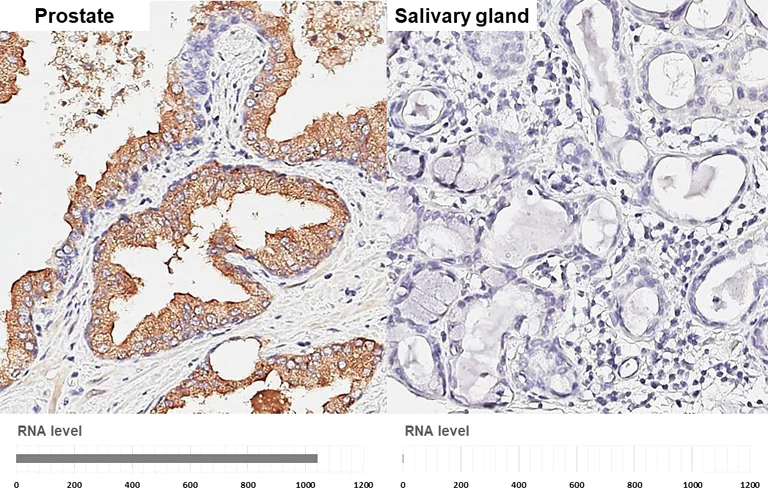 Immunohistochemistry (Formalin/PFA-fixed paraffin-embedded sections) - Anti-Kallikrein 2/KLK2 antibody (AB152136)