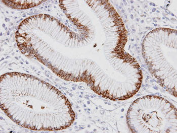 Immunohistochemistry (Formalin/PFA-fixed paraffin-embedded sections) - Anti-Kallikrein 2/KLK2 antibody (AB152136), expandable thumbnail