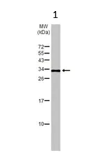 Western blot - Anti-Kallikrein 2/KLK2 antibody (AB152136)