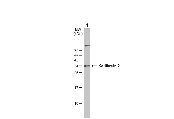 Western blot - Anti-Kallikrein 2/KLK2 antibody (AB152136)