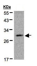 Western blot - Anti-Kallikrein 2/KLK2 antibody (AB152136), expandable thumbnail