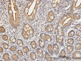 Immunohistochemistry (Formalin/PFA-fixed paraffin-embedded sections) - Anti-Kallikrein 2/KLK2 antibody (AB169269)