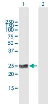 Western blot - Anti-Kallikrein 2/KLK2 antibody (AB169269)