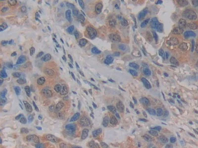 Immunohistochemistry (Formalin/PFA-fixed paraffin-embedded sections) - Anti-Kallikrein 2/KLK2 antibody (AB232980)