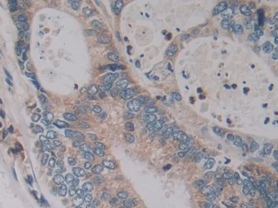 Immunohistochemistry (Formalin/PFA-fixed paraffin-embedded sections) - Anti-Kallikrein 2/KLK2 antibody (AB232980)