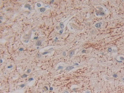Immunohistochemistry (Formalin/PFA-fixed paraffin-embedded sections) - Anti-Kallikrein 2/KLK2 antibody (AB232980)