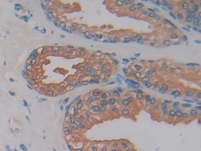 Immunohistochemistry (Formalin/PFA-fixed paraffin-embedded sections) - Anti-Kallikrein 2/KLK2 antibody (AB232980)