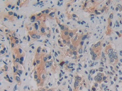 Immunohistochemistry (Formalin/PFA-fixed paraffin-embedded sections) - Anti-Kallikrein 2/KLK2 antibody (AB232980)