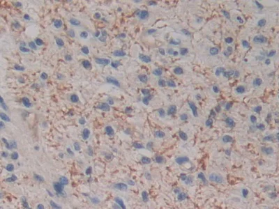 Immunohistochemistry (Formalin/PFA-fixed paraffin-embedded sections) - Anti-Kallikrein 2/KLK2 antibody (AB232980)