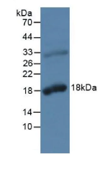 Western blot - Anti-Kallikrein 2/KLK2 antibody (AB232980)