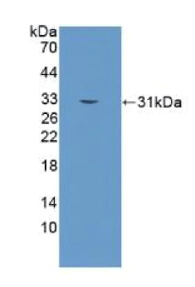 Western blot - Anti-Kallikrein 2/KLK2 antibody (AB232980)