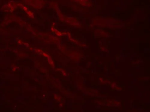 Immunocytochemistry/ Immunofluorescence - Anti-Kallikrein 4 antibody (AB181402)