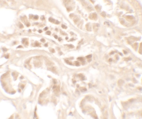 Immunohistochemistry (Formalin/PFA-fixed paraffin-embedded sections) - Anti-Kallikrein 4 antibody (AB181402)