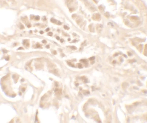 Immunohistochemistry (Formalin/PFA-fixed paraffin-embedded sections) - Anti-Kallikrein 4 antibody (AB181402)