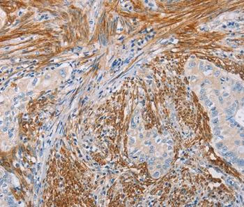 Immunohistochemistry (Formalin/PFA-fixed paraffin-embedded sections) - Anti-Kallikrein 4 antibody (AB197657)