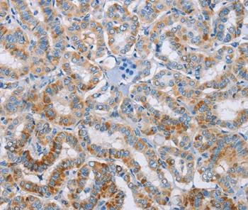 Immunohistochemistry (Formalin/PFA-fixed paraffin-embedded sections) - Anti-Kallikrein 4 antibody (AB197657)