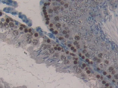 Immunohistochemistry (Formalin/PFA-fixed paraffin-embedded sections) - Anti-Kallikrein 4 antibody (AB231048)