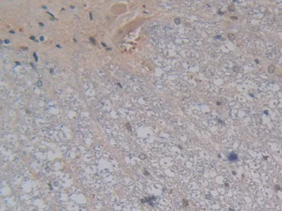Immunohistochemistry (Formalin/PFA-fixed paraffin-embedded sections) - Anti-Kallikrein 4 antibody (AB231048)