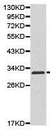 Western blot - Anti-Kallikrein 5 antibody (AB176299), expandable thumbnail