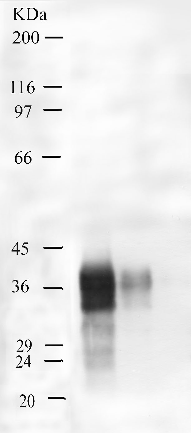 Western blot - Anti-Kallikrein 5 antibody (AB28565), expandable thumbnail