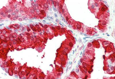 Immunohistochemistry (Formalin/PFA-fixed paraffin-embedded sections) - Anti-Kallikrein 6 antibody (AB191281), expandable thumbnail
