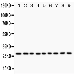 Western blot - Anti-Kallikrein 6 antibody - C-terminal (AB190924)