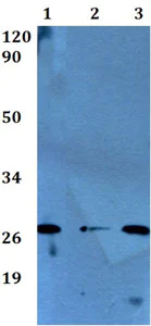 Western blot - Anti-Kallikrein 7/KLK7 antibody (AB200745)