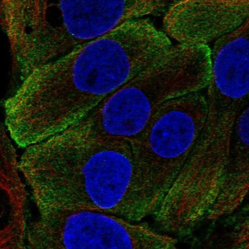 Immunocytochemistry/ Immunofluorescence - Anti-Kallikrein 7/KLK7 antibody (AB244367)