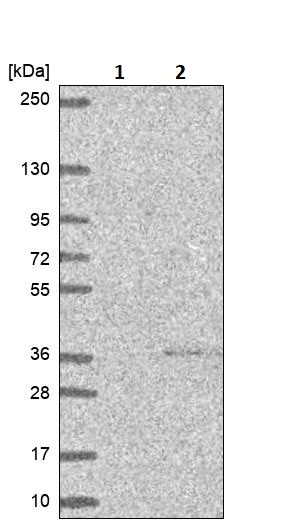 Western blot - Anti-Kallikrein 7/KLK7 antibody (AB244367)