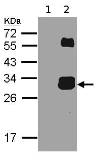 Western blot - Anti-Kallikrein 7/KLK7 antibody (AB96710)