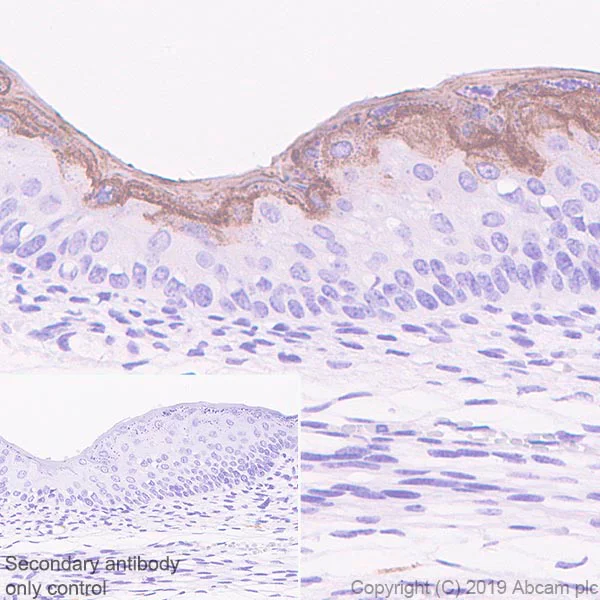 Immunohistochemistry (Formalin/PFA-fixed paraffin-embedded sections) - Anti-Kallikrein 7/KLK7 antibody [EPR22594-203] - BSA and Azide free (AB255328)