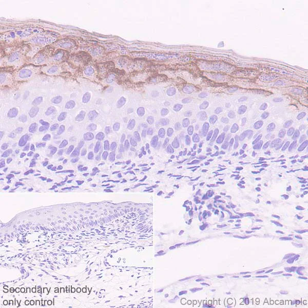 Immunohistochemistry (Formalin/PFA-fixed paraffin-embedded sections) - Anti-Kallikrein 7/KLK7 antibody [EPR22594-203] - BSA and Azide free (AB255328)