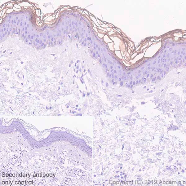 Immunohistochemistry (Formalin/PFA-fixed paraffin-embedded sections) - Anti-Kallikrein 7/KLK7 antibody [EPR22594-203] - BSA and Azide free (AB255328)