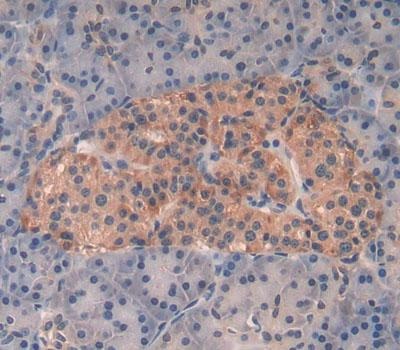 Immunohistochemistry (Formalin/PFA-fixed paraffin-embedded sections) - Anti-Kallikrein 8/KLK8 antibody (AB232839), expandable thumbnail