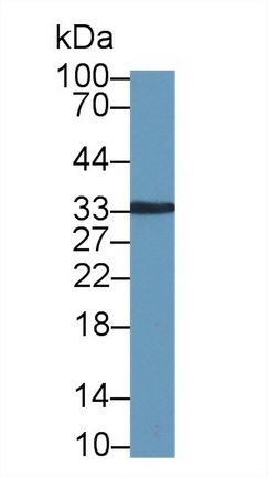 Western blot - Anti-Kallikrein 8/KLK8 antibody (AB232839), expandable thumbnail