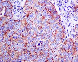 Immunohistochemistry (Formalin/PFA-fixed paraffin-embedded sections) - Anti-Kallikrein 8/KLK8 antibody [EPR5752(2)] - BSA and Azide free (AB248964)