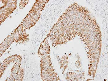 Immunohistochemistry (Formalin/PFA-fixed paraffin-embedded sections) - Anti-Kallistatin/PI-4 antibody (AB154597)