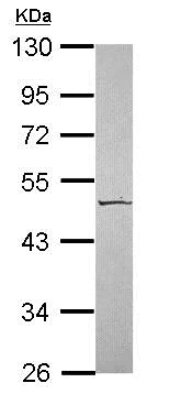 Western blot - Anti-Kallistatin/PI-4 antibody (AB154597)