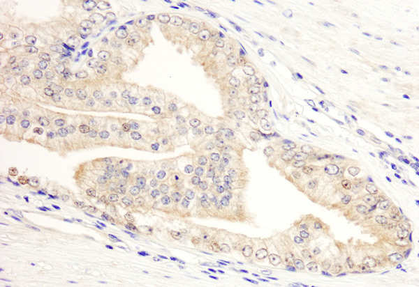 Immunohistochemistry (Formalin/PFA-fixed paraffin-embedded sections) - Anti-KANK2 antibody (AB99351), expandable thumbnail